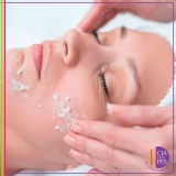 clínica de estética para peeling locais Paraíso